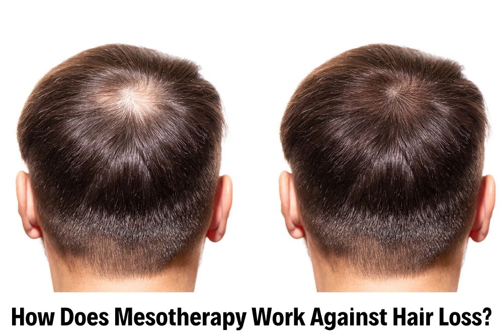 Hair Mesotherapy